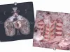 Eimi Suzuki Handkerchief Group 1 - option 3 OR option 4