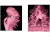 Kazuki Takamatsu We Are Free to Kill SIGNED- inside page