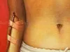 Trevor Brown Pink Transfusion Original Painting - detail